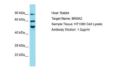 Western Blot: BRSK2 Antibody [NBP2-86587]