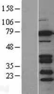 Western Blot: BRSK2 Overexpression Lysate [NBL1-08032]