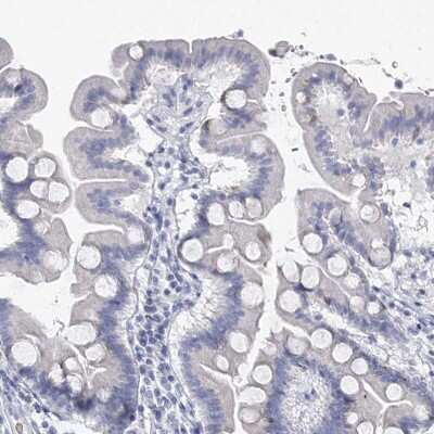 Immunohistochemistry-Paraffin: BRUNOL4 Antibody [NBP1-89932]