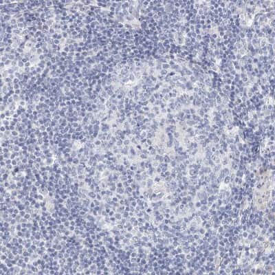 Immunohistochemistry-Paraffin: BRUNOL4 Antibody [NBP1-89932]