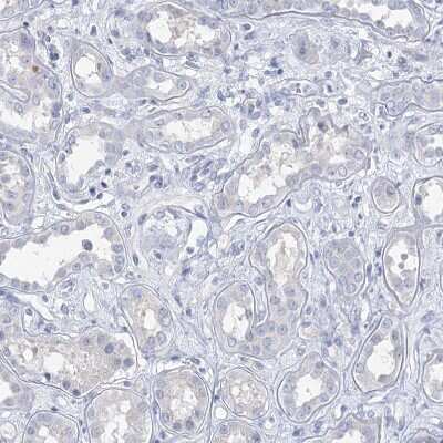Immunohistochemistry-Paraffin: BRUNOL4 Antibody [NBP1-89932]