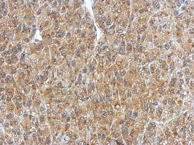 Immunohistochemistry-Paraffin: BRUNOL4 Antibody [NBP2-15622]