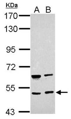 Western Blot: BRUNOL4 Antibody [NBP2-15622]