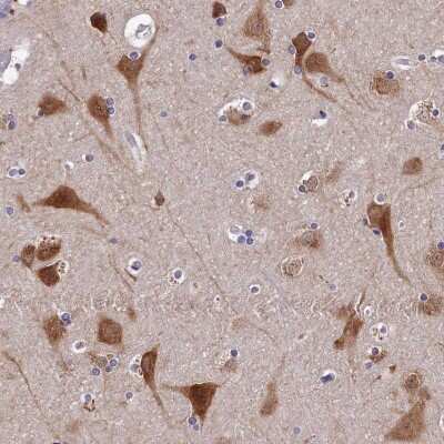 Immunohistochemistry-Paraffin: BRUNOL5 Antibody [NBP1-89931]
