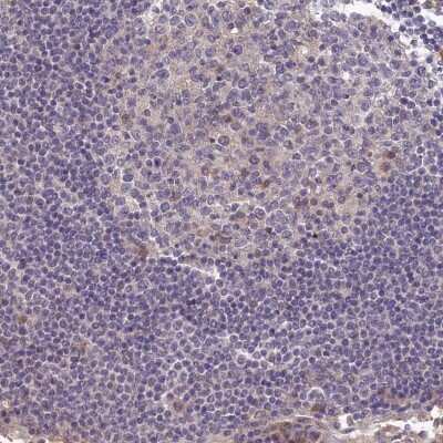 Immunohistochemistry-Paraffin: BRUNOL5 Antibody [NBP1-89931]