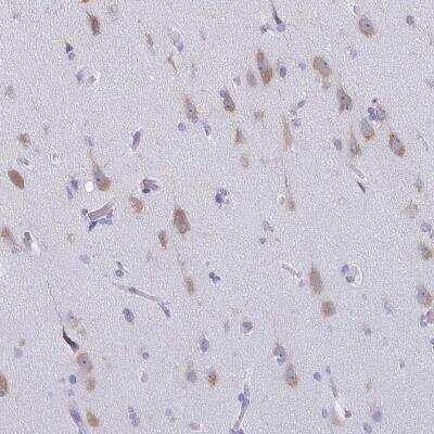 Immunohistochemistry-Paraffin: BRUNOL5 Antibody [NBP2-34134]