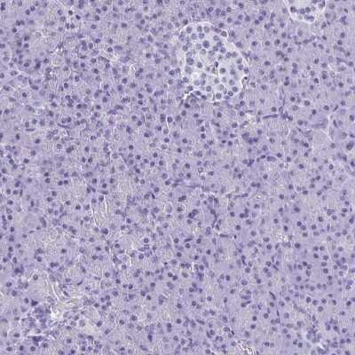 Immunohistochemistry-Paraffin: BRUNOL5 Antibody [NBP2-34134]