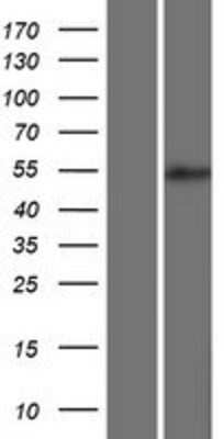 Western Blot: BRUNOL5 Overexpression Lysate [NBP2-06501]