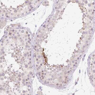Immunohistochemistry-Paraffin: BRUNOL6 Antibody [NBP2-31562]