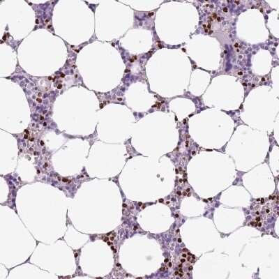 Immunohistochemistry-Paraffin: BRUNOL6 Antibody [NBP2-32050]