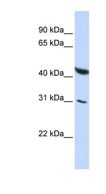 Western Blot: BRUNOL6 Antibody [NBP1-57256]