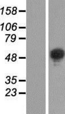 Western Blot: BRUNOL6 Overexpression Lysate [NBP2-05858]