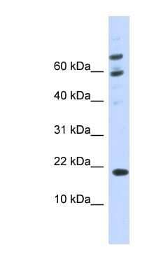 Western Blot: BRWD1-IT2 Antibody [NBP1-91595]