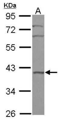 Western Blot: BRIX Antibody [NBP2-15623]