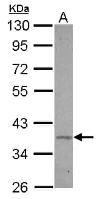 Western Blot: BRIX Antibody [NBP2-15624]