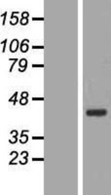 Western Blot: BRIX Overexpression Lysate [NBL1-08062]