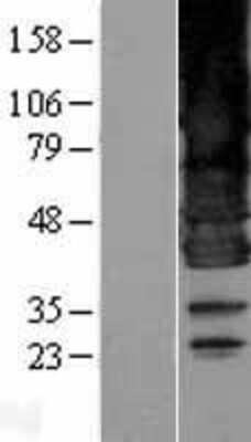 Western Blot: Seipin/BSCL2 Overexpression Lysate [NBL1-08035]