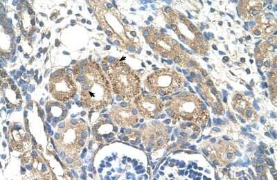 Immunohistochemistry-Paraffin: BSDC1 Antibody [NBP1-70421]