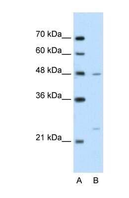 Western Blot: BSDC1 Antibody [NBP1-70421]