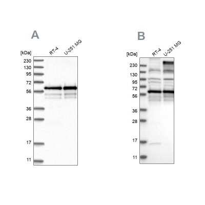 Western Blot: BSDC1 Antibody [NBP1-84644]