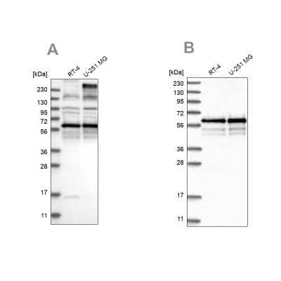 Western Blot: BSDC1 Antibody [NBP2-38180]