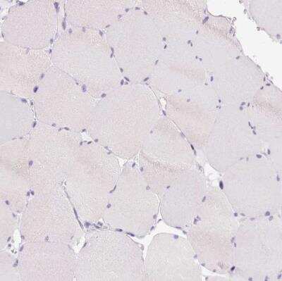 Immunohistochemistry-Paraffin: BSND Antibody [NBP2-49101]
