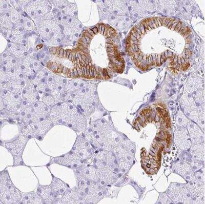 Immunohistochemistry-Paraffin: BSND Antibody [NBP2-49101]