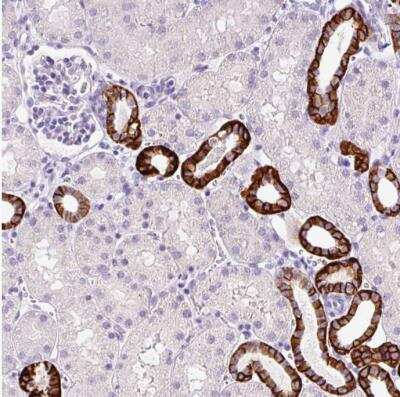 Immunohistochemistry-Paraffin: BSND Antibody [NBP2-49101]