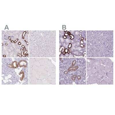Immunohistochemistry-Paraffin: BSND Antibody [NBP2-49101]