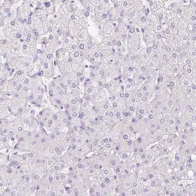 Immunohistochemistry-Paraffin: BSND Antibody [NBP2-49101]