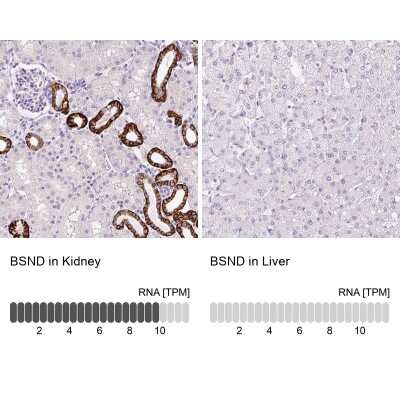 Immunohistochemistry-Paraffin: BSND Antibody [NBP2-49101]