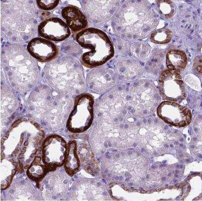 Immunohistochemistry-Paraffin: BSND Antibody [NBP2-62634]