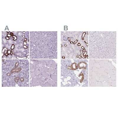 Immunohistochemistry-Paraffin: BSND Antibody [NBP2-62634]