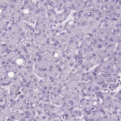 Immunohistochemistry-Paraffin: BSND Antibody [NBP2-62634]