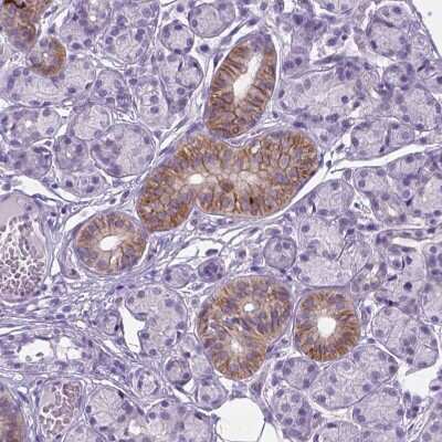 Immunohistochemistry-Paraffin: BSND Antibody [NBP2-62634]