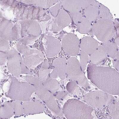 Immunohistochemistry-Paraffin: BSND Antibody [NBP2-62634]