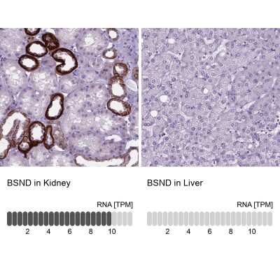 Immunohistochemistry-Paraffin: BSND Antibody [NBP2-62634]