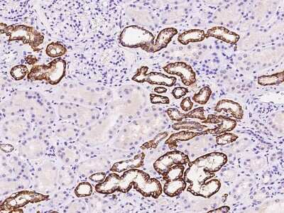 Immunohistochemistry-Paraffin: BSND Antibody [NBP2-98588]