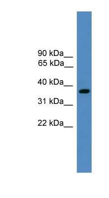 Western Blot: BSND Antibody [NBP1-79770]