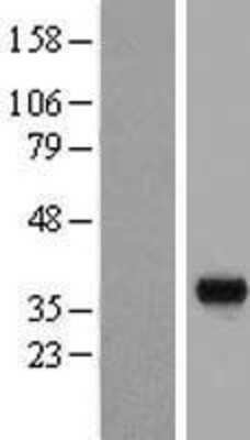 Western Blot: BSND Overexpression Lysate [NBP2-05803]