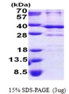 SDS-PAGE: Recombinant Human BSND His Protein [NBP2-22704]