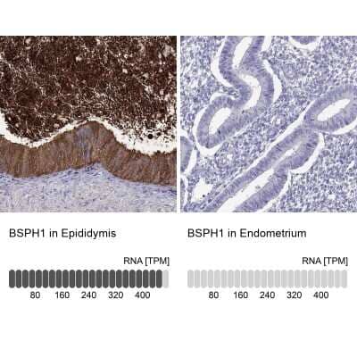 Immunohistochemistry-Paraffin: BSPH1 Antibody [NBP2-62617]