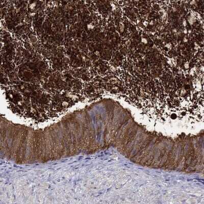 Immunohistochemistry-Paraffin: BSPH1 Antibody [NBP2-62617]