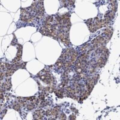 Immunohistochemistry-Paraffin: BSPRY Antibody [NBP3-17219]