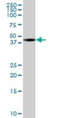 Western Blot: BSPRY Antibody [H00054836-B01P]