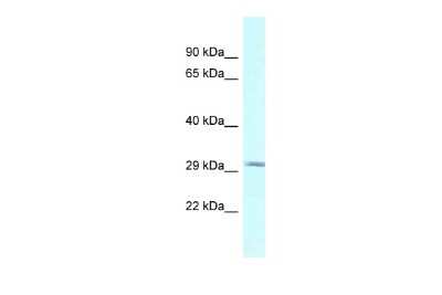 Western Blot: BSPRY Antibody [NBP2-84517]