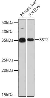 Western Blot: BST2 Antibody (0F5P3) [NBP3-16710]