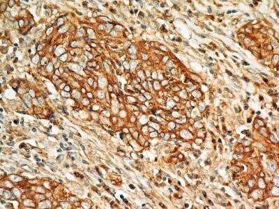 Immunohistochemistry: BST2 Antibody (2E2) - Azide and BSA Free [NBP2-80603]