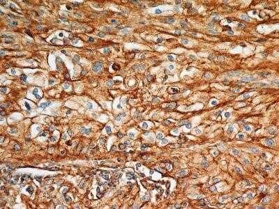 Immunohistochemistry: BST2 Antibody (2E2) - Azide and BSA Free [NBP2-80603]