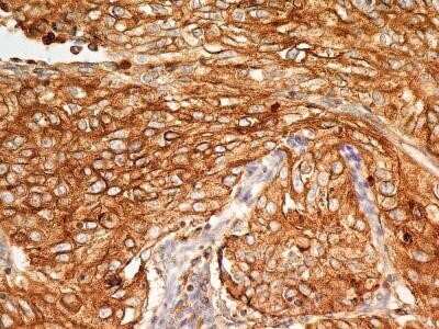 Immunohistochemistry-Paraffin: BST2 Antibody (2E2) - Azide and BSA Free [NBP2-80603]